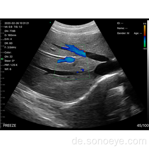 Convex Probe Wireless Mini Ultraschallscanner